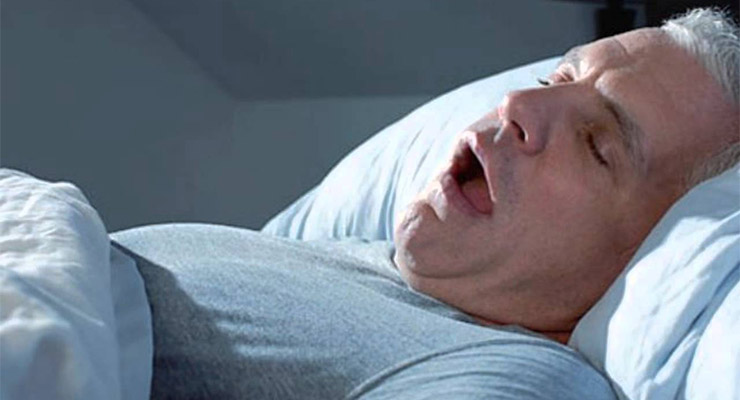 ¿Qué es la apnea del sueño y cómo se trata?