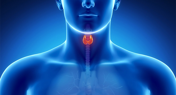 Cáncer de tiroides