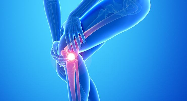 Una luxación bien tratada puede garantizarle una vida normal