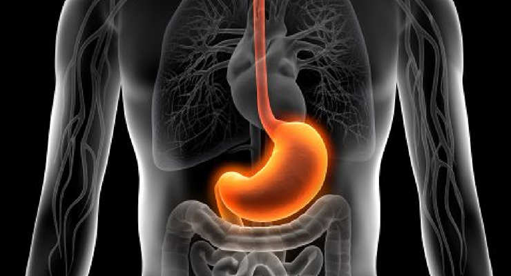 Gastritis, cómo tratarla