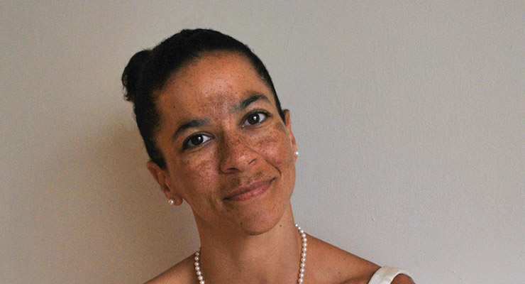 Melasma, efecto indeseado de la exposición al sol