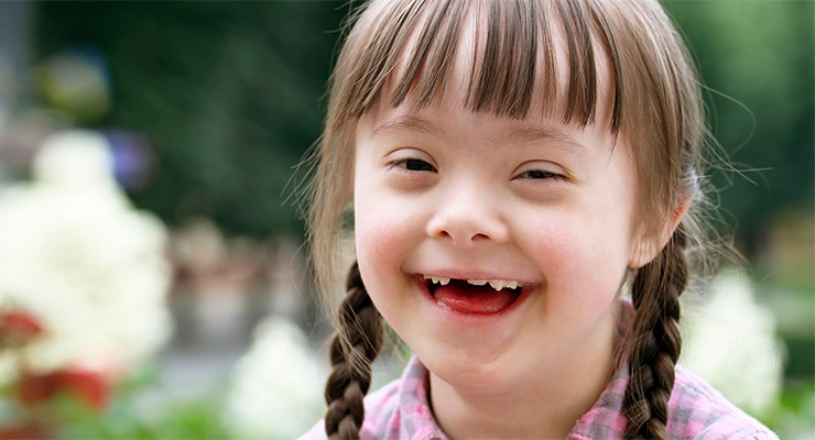 Día Mundial del Síndrome de Down