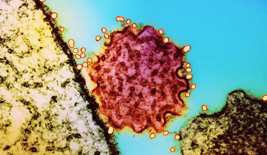 Virus Nipah: qué es, por qué se monitorea y cómo cuidarte con prevención responsable