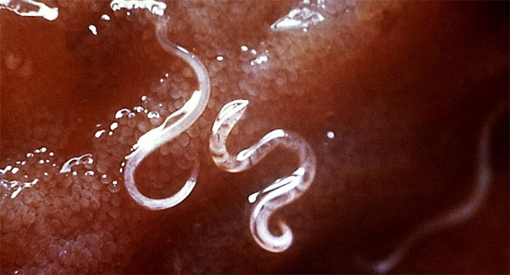 ¿Amebas o lombrices? Como diferenciarlo en los niños