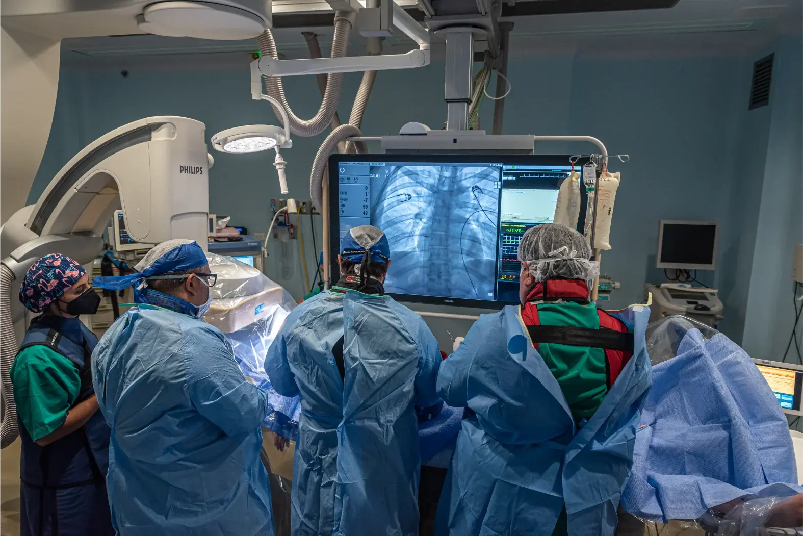 Equipo médico realizando procedimiento guiado por imagen en quirófano