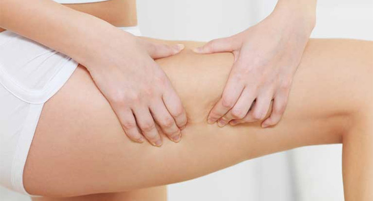 Trate oportunamente la retención de líquido