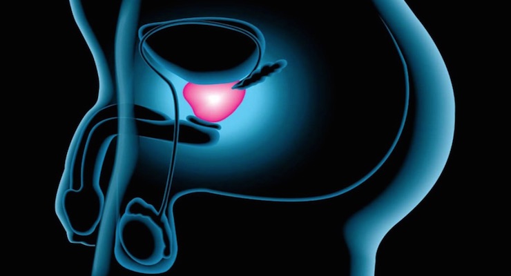 Reduzca el riesgo de sufrir Cáncer de próstata