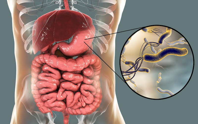 Genomic determinants of antibiotic resistance for Helicobacter pylori treatment: a retrospective phenotypic and genotypic observational study