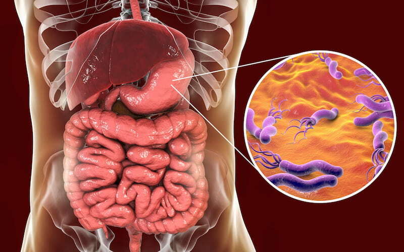 Artificial Intelligence in Helicobacter Pylori Infection: Diagnostic Applications and Emerging Treatment-Related Predictive Uses—A Systematic Review