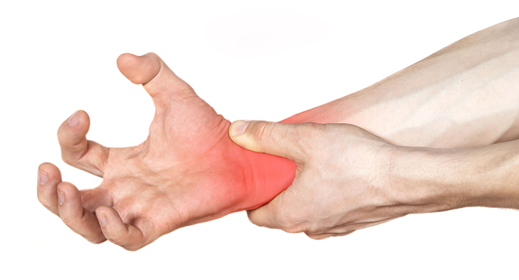 Fisioterapia para tratar el síndrome del túnel del carpo