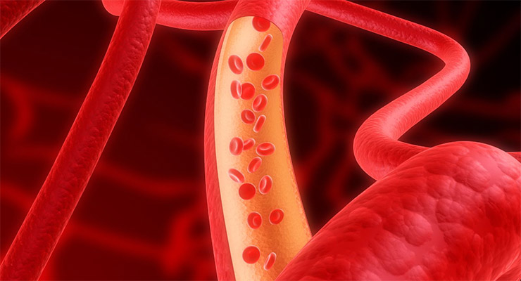 Diabetes, lucha diaria de muchos costarricenses