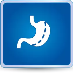 Bariatric Surgery