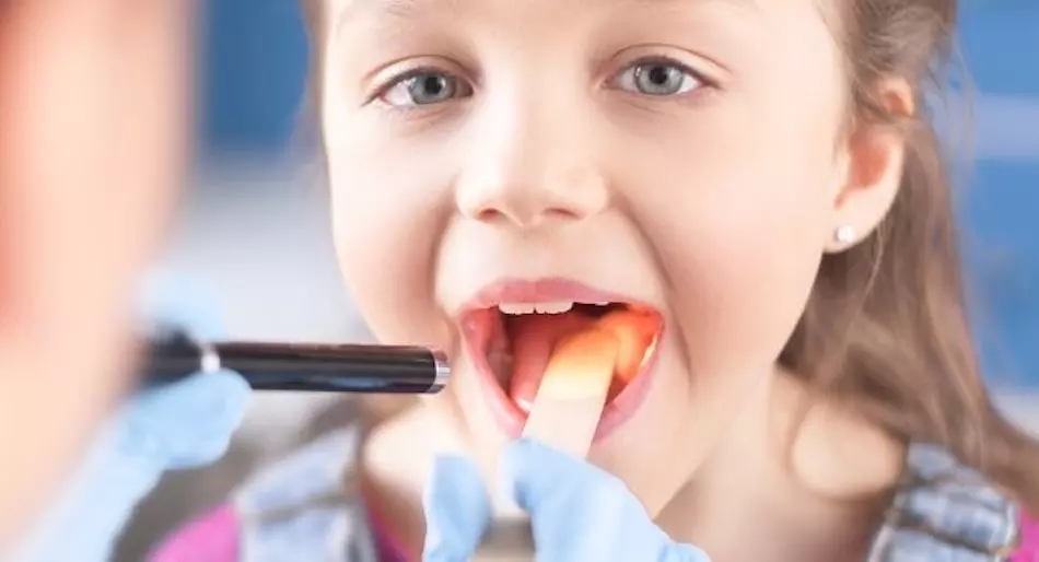 ¿Qué son las amígdalas y las adenoides? Conozca sobre el tratamiento pediátrico 