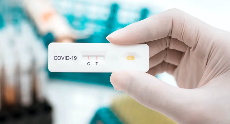 antigen tests for COVID19 detection - Hospital Clínica bíblica