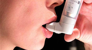 Asthma