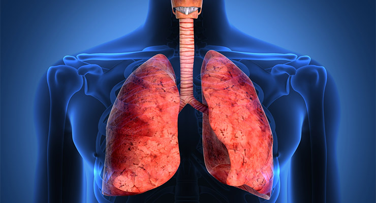 Lung Cancer
