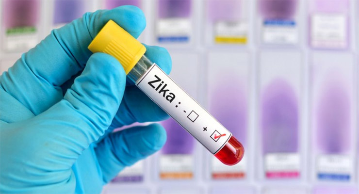 Detección de zika